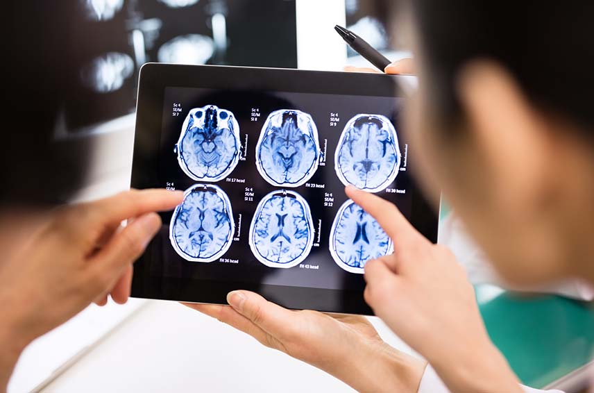 Doctors looking at brain scans on tablet