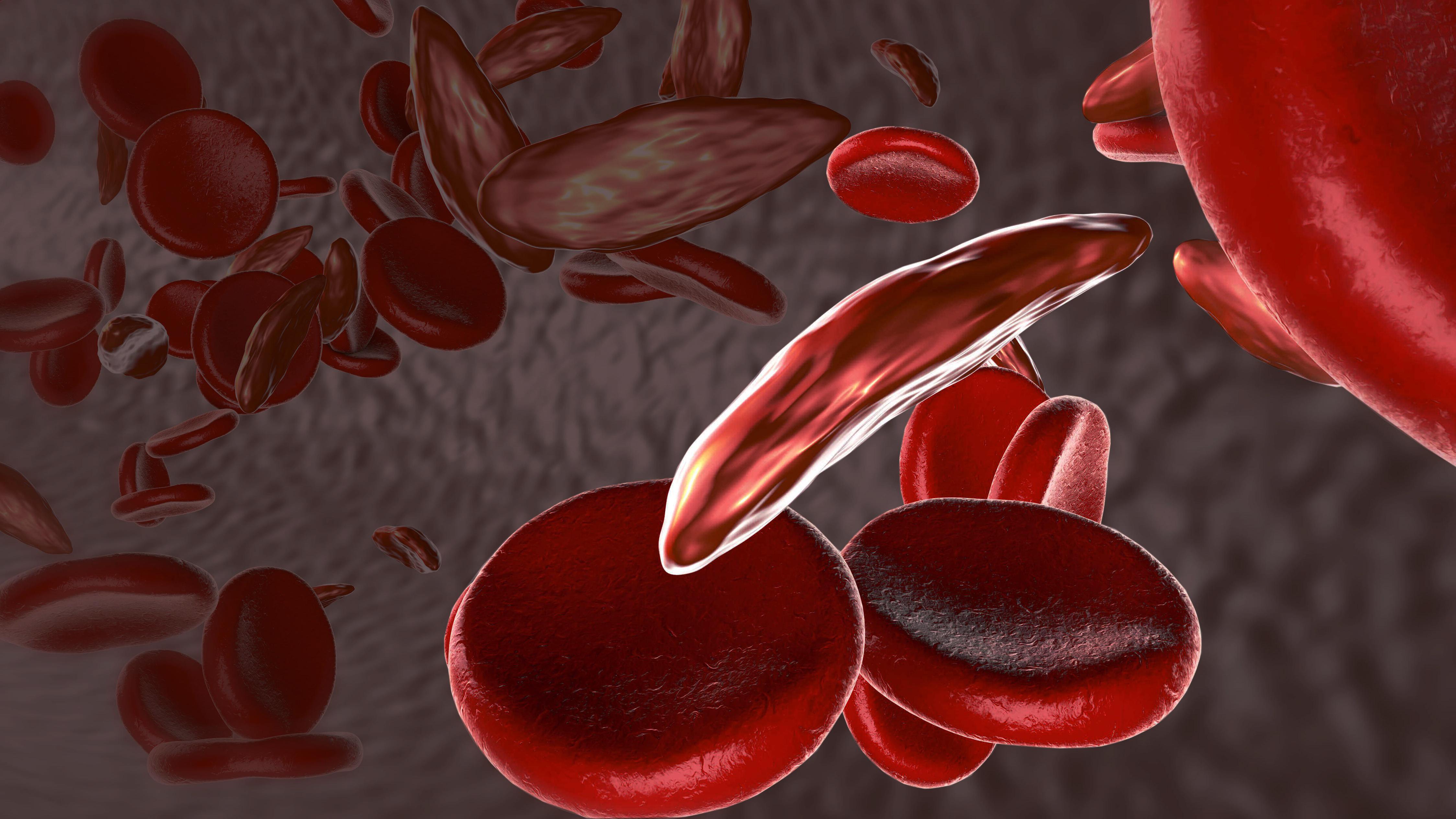 3D Rendering of Sickle Cells and normal cells