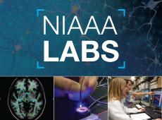 NIAAA Labs. 4 images made of 2 images of the brain and 2 of staff at work.