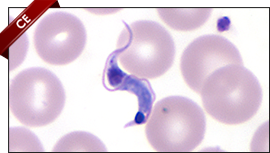 Blood smear with trypomastigote form of Trypanosoma cruzi, the causative agent for Chagas disease.