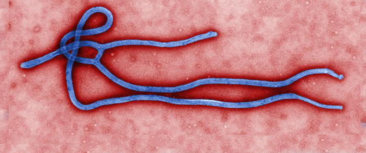 Transmission electron micrograph of an Ebola virus virion (Image: CDC/Cynthia Goldsmith)