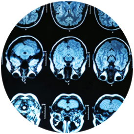 photo of brain scan