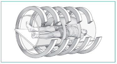 Drawing of a magnetic resonance imaging machine with a male patient lying on a table inside the hollow tunnel of the machine. The MRI magnets are shown as large bands that encircle the patient.