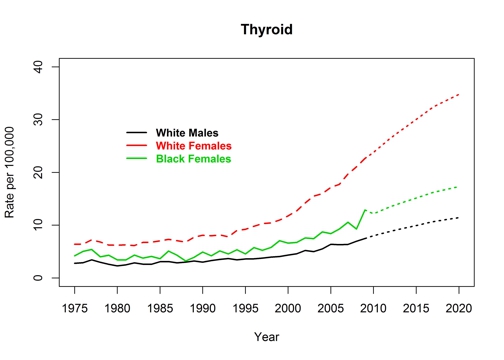 Graph showing actual and projected incidence rates for thyroid cancer by race and sex, United States, 1975 to 2020