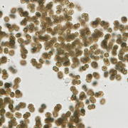 A colony of cyanobacteria cells from Lake Okeechobee, Florida