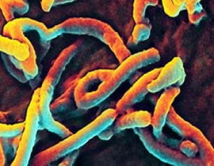 Scanning electron micrograph of Ebola virus budding from a cell (African green monkey kidney epithelial cell line).
