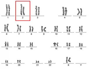 An image of all 46 chromosomes of the cured WHIM syndrome patient shows that one copy of chromosome 2 (red box) is significantly shorter than the other, a loss of genetic material caused by chromothripsis.
