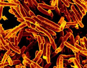 Scanning electron micrograph of Mycobacterium tuberculosis bacteria