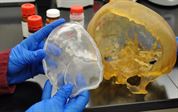 Navy Conducts New Cranial Reconstructive Research
