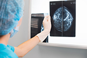 Electronic trigger detects mammogram follow-up delays - Photo: ©iStock/thomasandreas