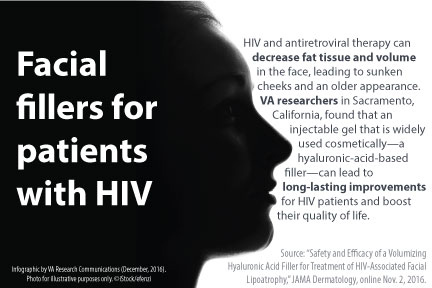 Facial fillers for patients with HIV