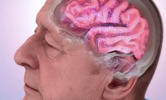 Animation showing an older man's brain