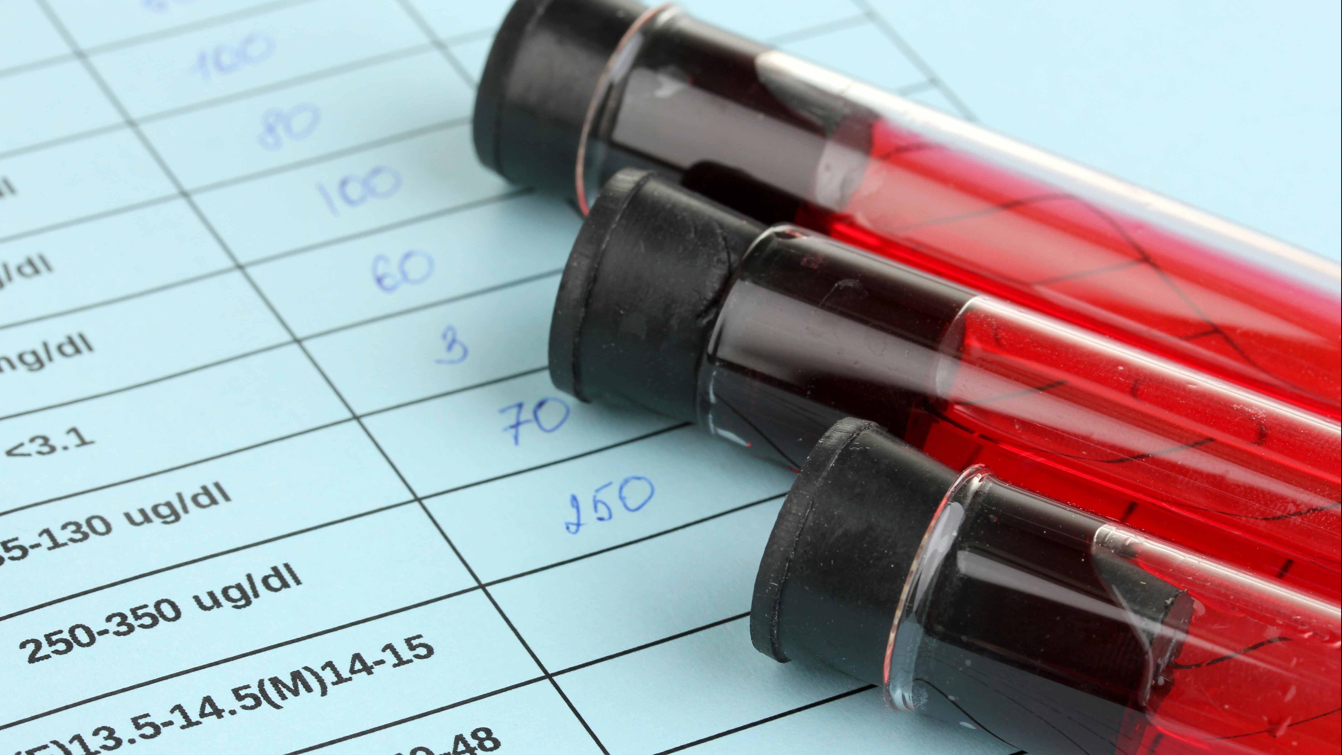 Blood vials laid on top of a medical chart.