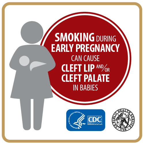 Pregnant Smokers and Cleft Lip and/or Cleft Palates in Babies