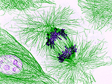Chromosomes (purple) being pulled apart during cell division.