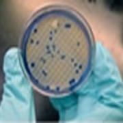 photo of a petri dish