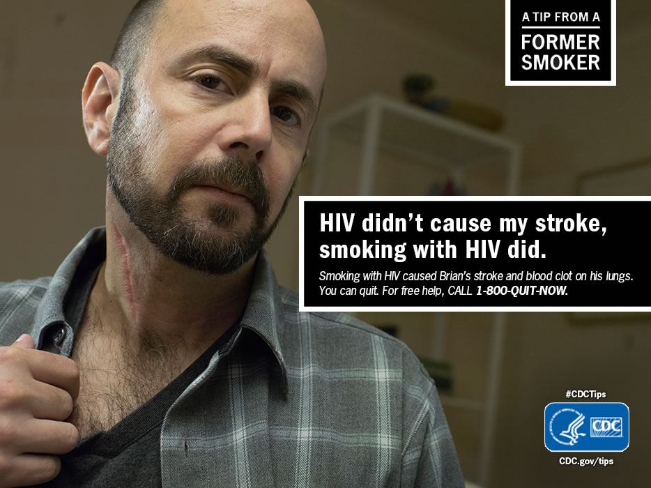 A Tip From a Former Smoker: HIV didn't cause my stroke, smoking with HIV did. For free help to quit smoking, call 1-800-QUIT-NOW. 
