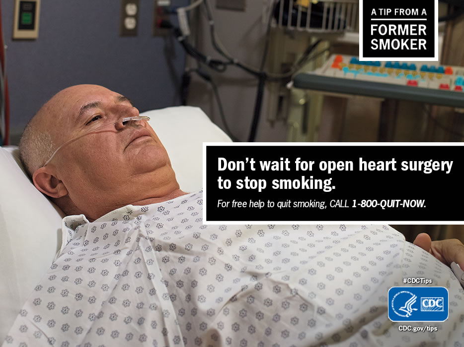 A Tip From a Former Smoker: Don't wait for open heart surgery to stop smoking. For free help to quit smoking, call 1-800-QUIT-NOW. 