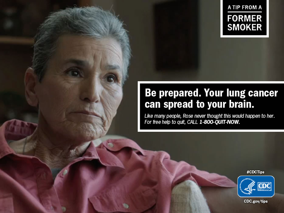 A Tip From a Former Smoker: Be prepared. Your lung cancer can spread to your brain. For free help to quit smoking, call 1-800-QUIT-NOW. 