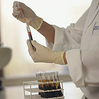 A lab technician drawing a blood sample from a test tube