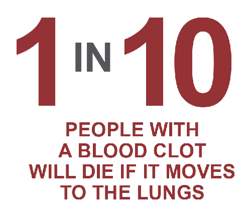 1 in 10 people with a blood clot will die if it moves to the lungs