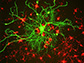 cortical neuron stained with antibody to neurofilament subunit NF-L in green