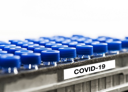 rack of test tubes labeled COVID-19