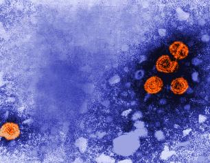 A transmission electron microscopic (TEM) image showing clusters of round hepatitis B viral particles, colored orange.