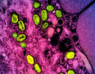 Monkeypox particles (green) found within an infected cell (pink and purple)