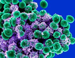 SEM image of Staphylococcus epidermidis bacteria