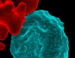 Malaria Infected Blood Cell