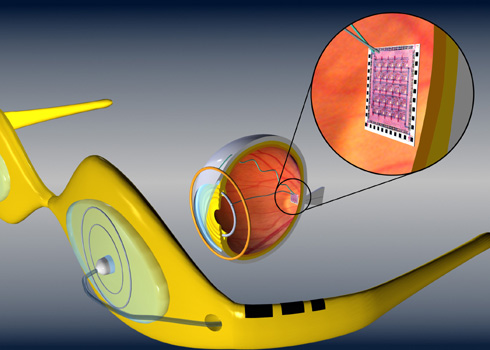 A schematic photo that shows how an intraocular retinal prosthesis can create artificial 
      vision for those with low or no vision.