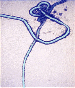 Microscope image of Ebola virus