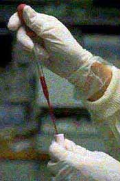 Graphic showing a pipette used in toxicology examinations