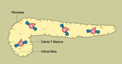 Una ilustracin del pncreas que contiene clulas T maduras y clulas beta.