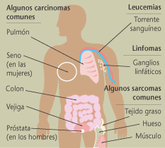 Ilustracin del cuerpo humano mostrando los sitios y tipos de algunos cnceres.