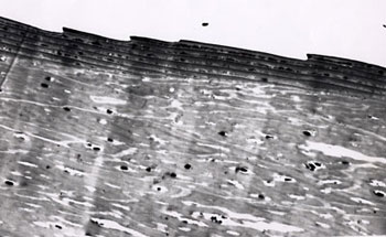 Figure 84. Transmission Electron Photomicrograph of Cuticular Scales Provided to the FBI Laboratory by Charles Lynch