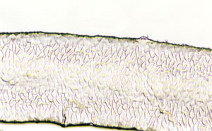 Figure 115 is a photomicrograph of a scale pattern of antelope hair.