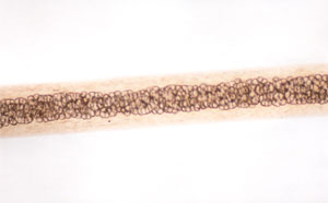 Figure 119 is a photomicrograph of seal hair.