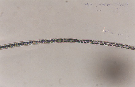 Figure 10 is a photomicrograph of uniserial ladder medulla.
