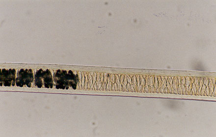 Figure 12 is a photomicrograph of animal hair.