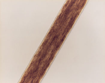 Figure 39 is a photomicrograph of head hair of Caucasian individual.