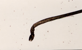 Figure 57 is a photomicrograph of anagen hair root.