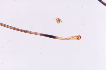 Figure 81 is a photomicrograph of postmortem root band.