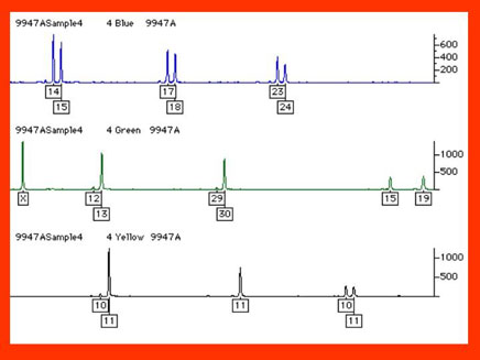 Figure 8 illustrates an AmpFlSTR Profiler Plus STR data collected 
              on an ABI PRISM 310 genetic analyzer.