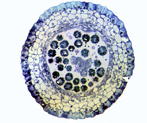 Cross-Section of Moss Spore Capsule