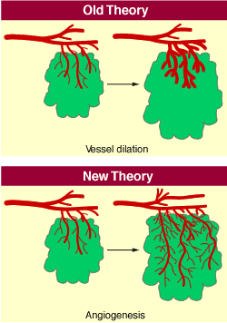 Two drawings of blood vessels and surrounding tissue