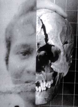 Photographic superimposition of an unidentified human skull from a 1991 Smithsonian-FBI case