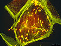 Bacterium Listeria Monocytogenes - Thumbnail