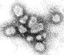 Negative stain image of the influenza A virus
